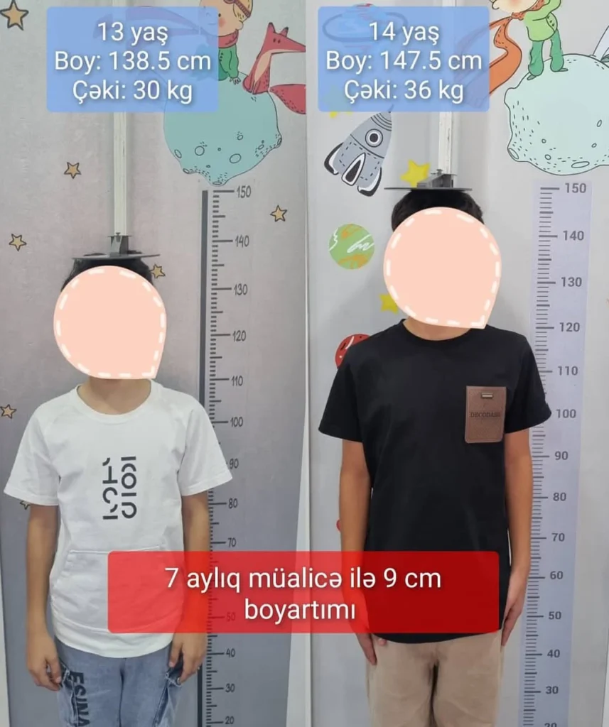 uşaqlarda boy qısalığı müalicəsi