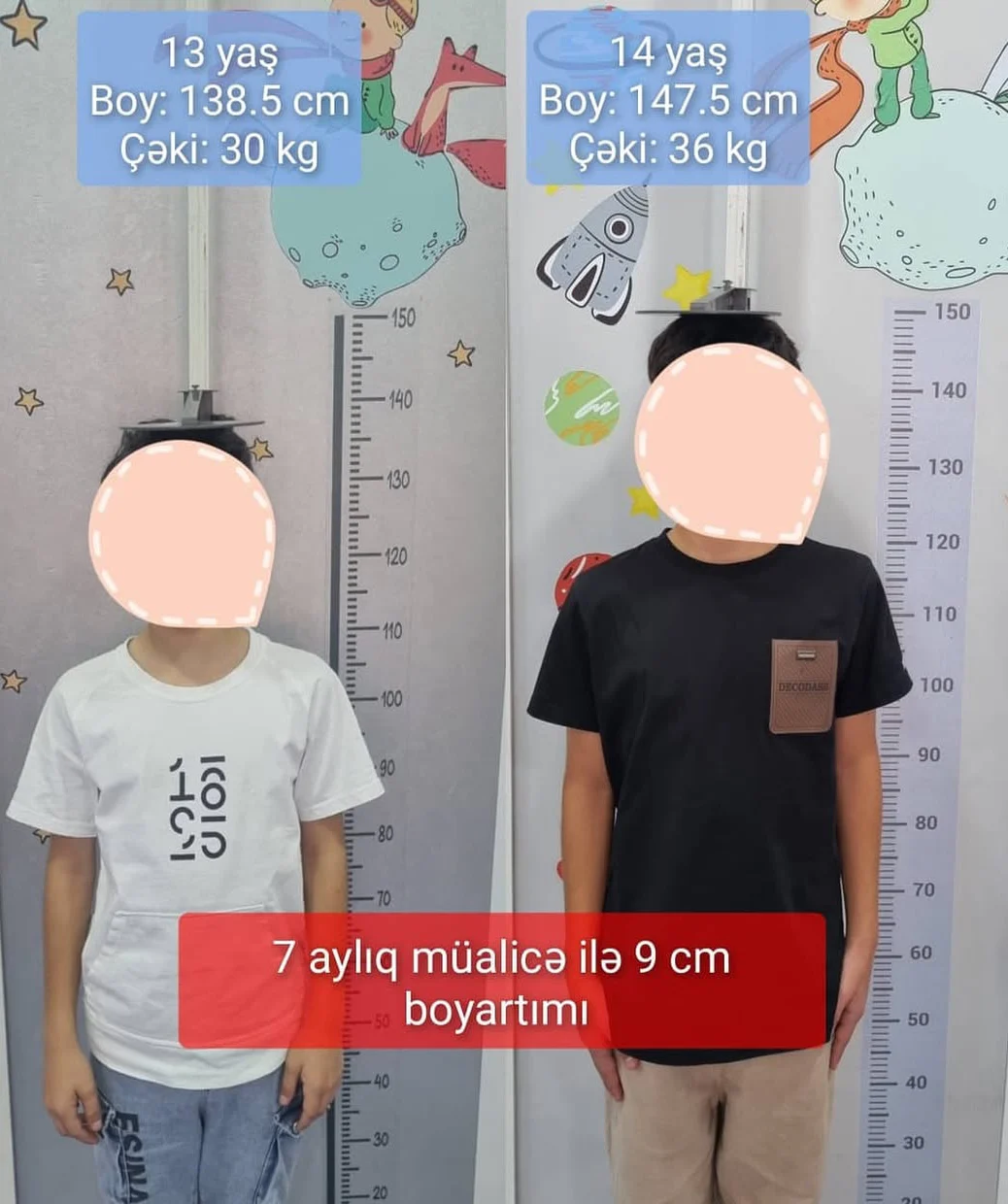 Boy artımı müalicəsi