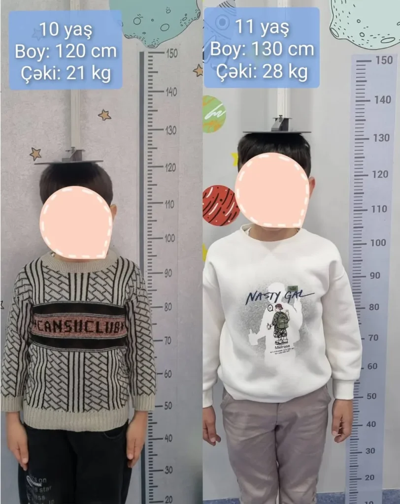uşaqlarda boy qısalığı 
