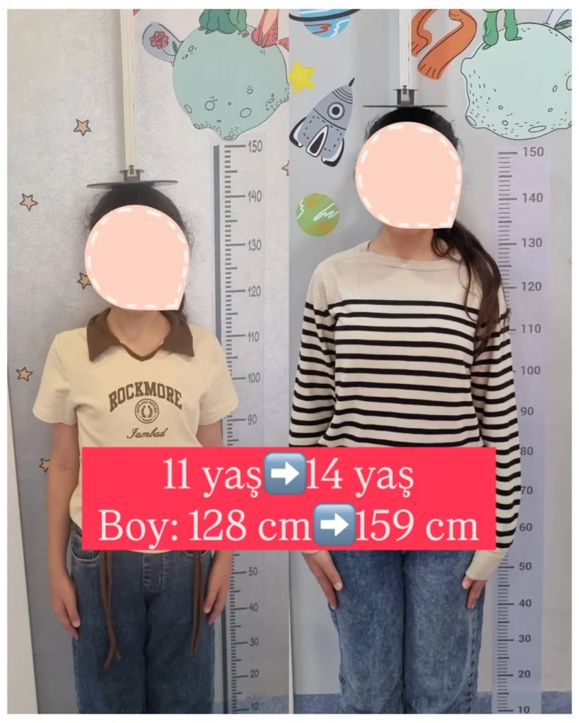 uşaqlarda boy qısalığı müalicəsi