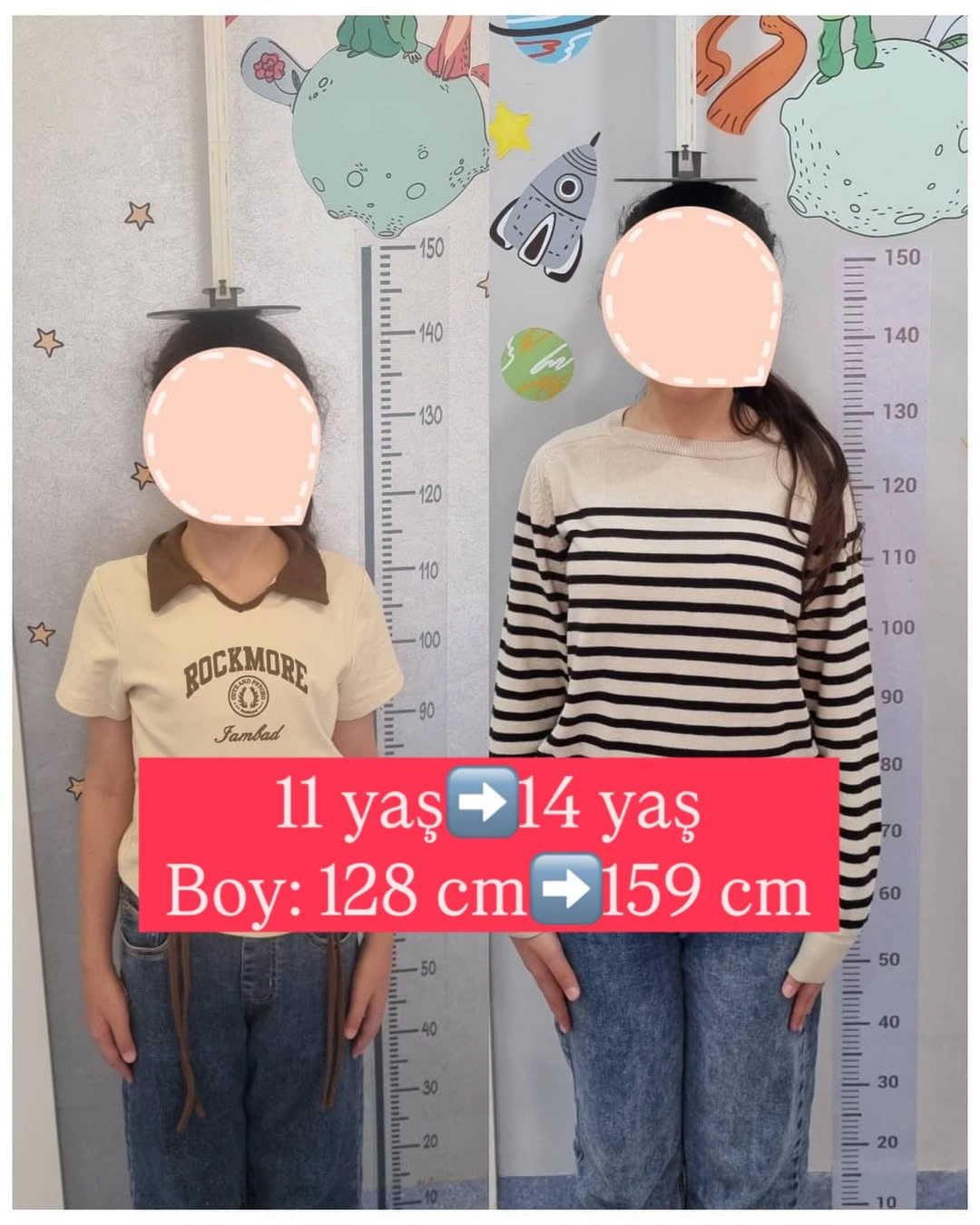 uşaqlarda boy artımı (1)