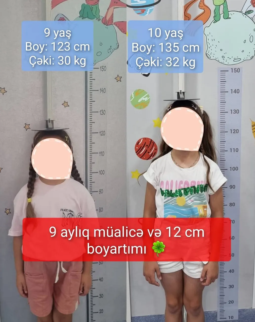 uşaqlarda boy qısalığı müalicəsi